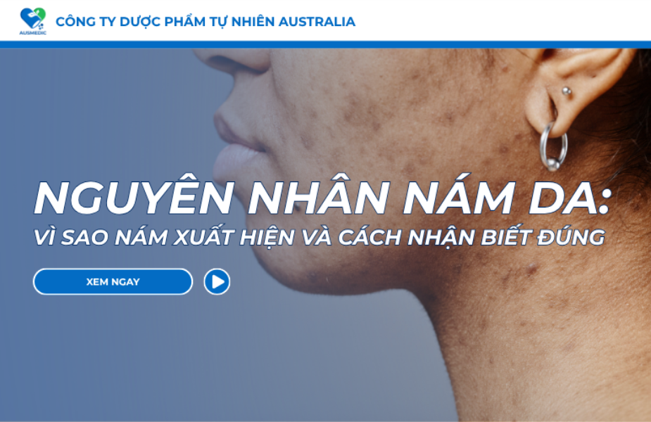Nguyên Nhân Nám Da: Vì Sao Nám Xuất Hiện Và Cách Nhận Biết Đúng
