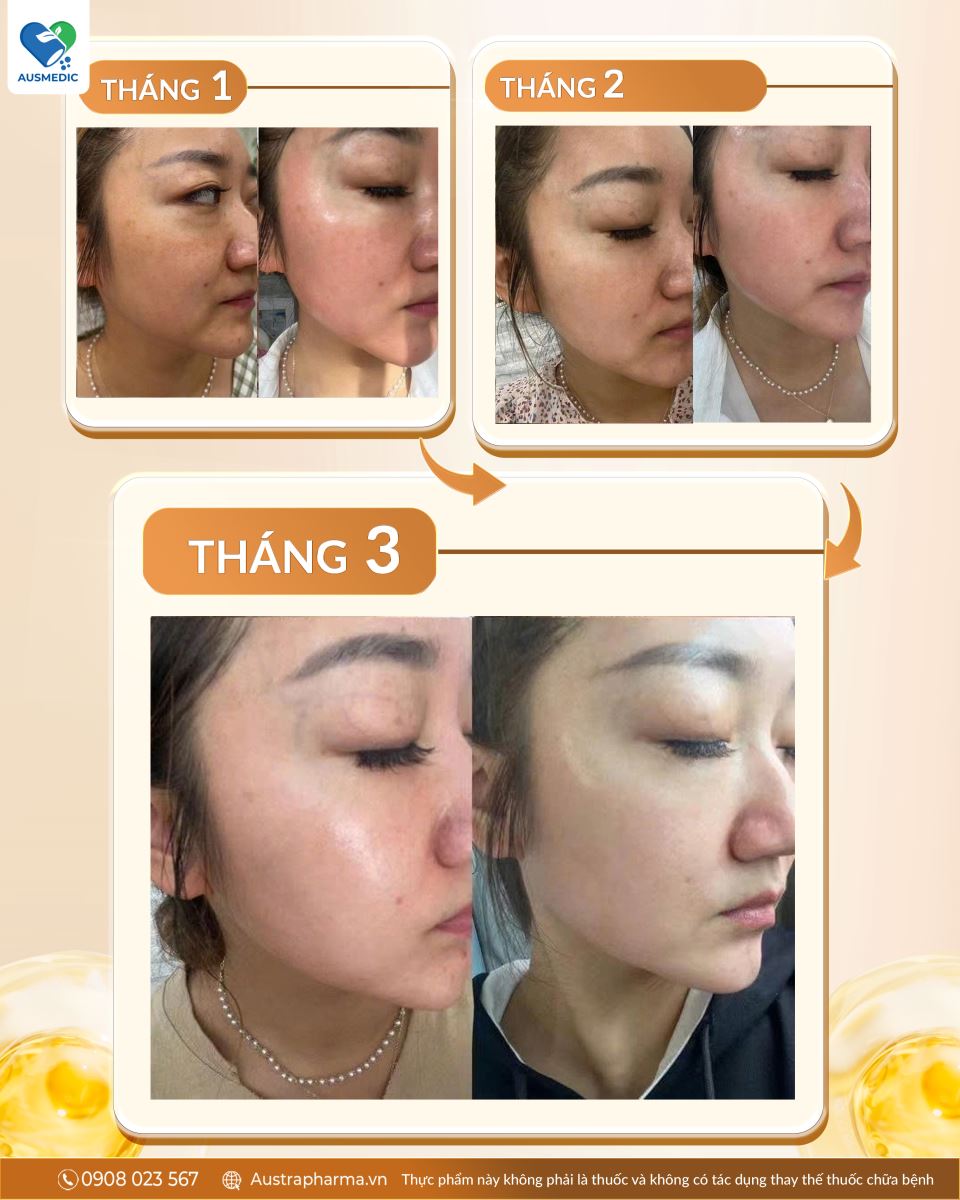 NEST BEAUTY - TÁI SINH LÀN DA, TRẺ MÃI KHÔNG GIÀ