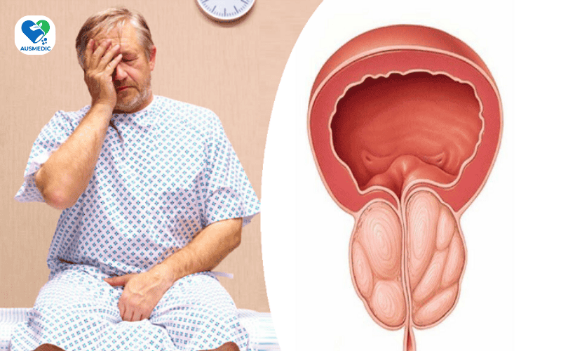 NEST STRONG: "CỨU CÁNH" CHO CEO PHÌ ĐẠI TUYẾN TIỀN LIỆT!