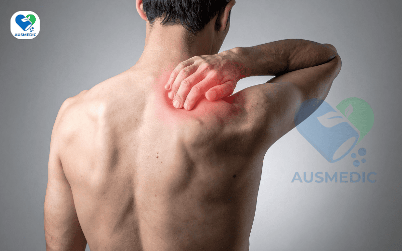 Đau cơ sau khi tập gym: Nguyên Nhân, Cách Giảm Nhanh Và Khi Nào Cần Gặp Bác Sĩ