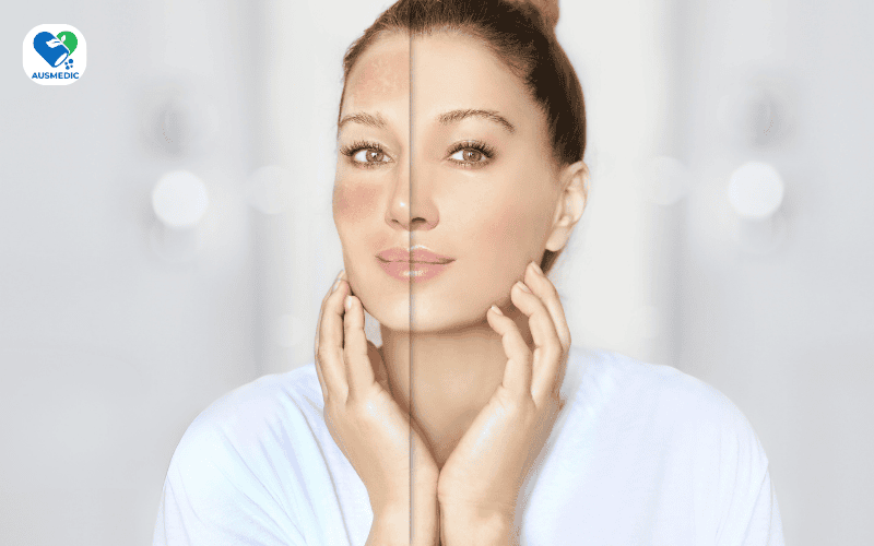 Uống gì để da trắng sáng từ bên trong? Hướng dẫn chi tiết và an toàn