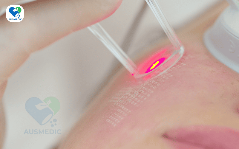 Phục Hồi Da Sau Laser: Không Chỉ Là Chăm Sóc Bên Ngoài